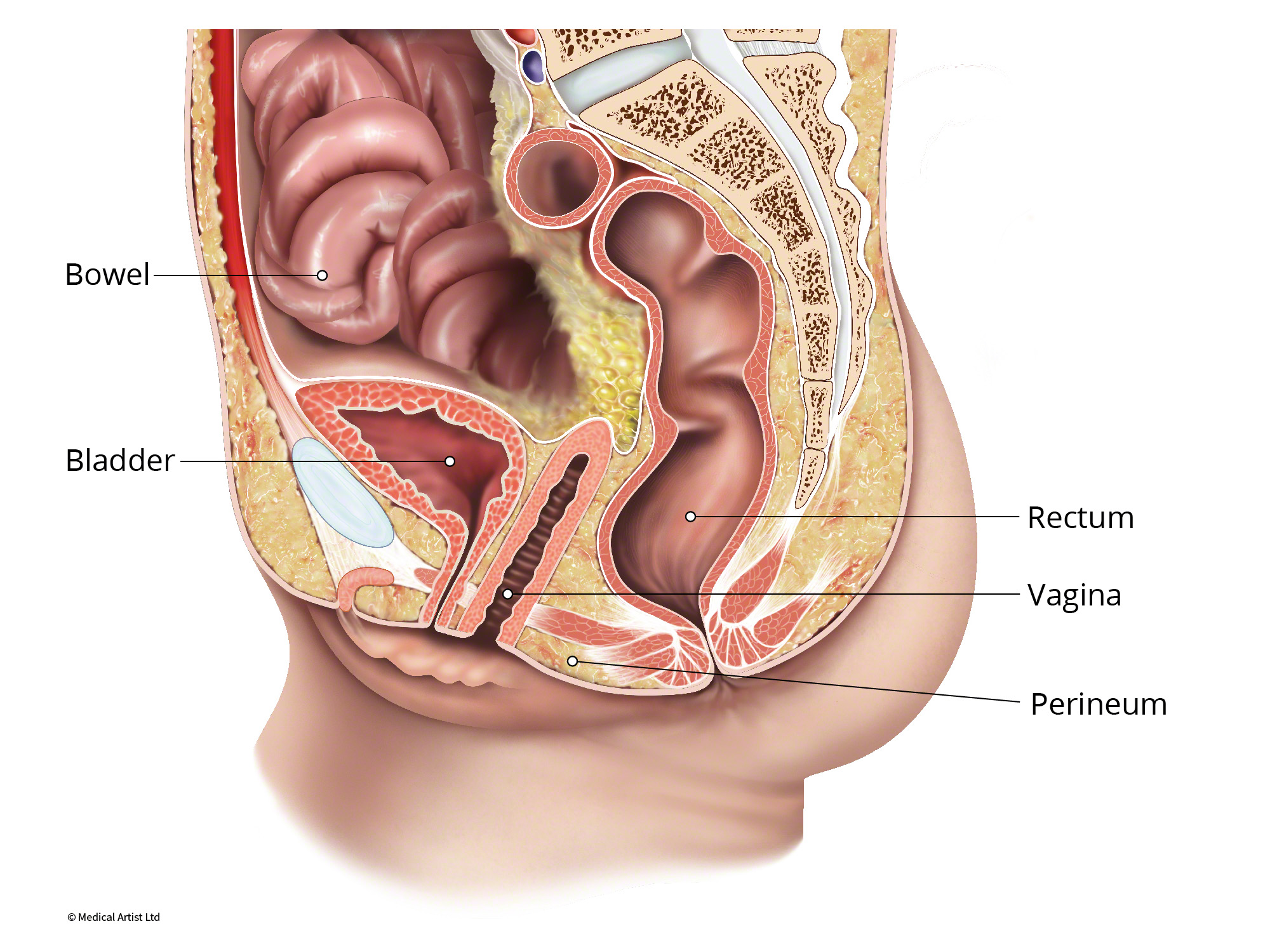 Enterocele Austin Urogynecology