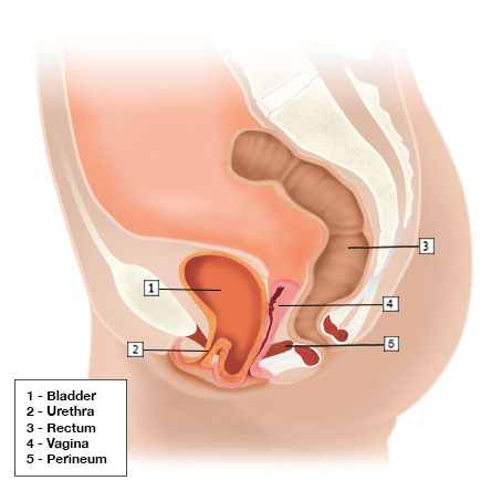 https://austinurogynecology.com/wp-content/uploads/2019/07/Cystocele-After-Hysterectomy.jpg