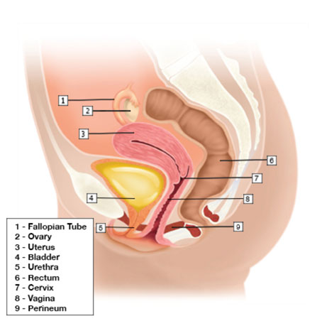 A Cystocele is Also Known As a Bladder Prolapse, a Fallen Bladder